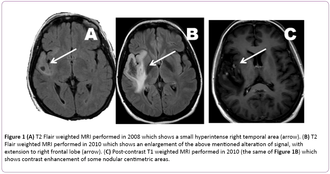 Forum on this topic: Brain Tumor Medications, brain-tumor-medications/ Discussion on this topic: Brain Tumor Medications, brain-tumor-medications/