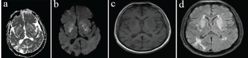 Click Here Figure 1