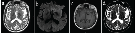 Click Here Figure 4