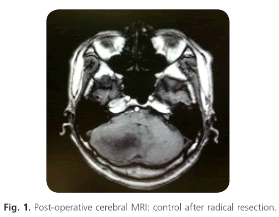 jneuro-cerebral-MRI