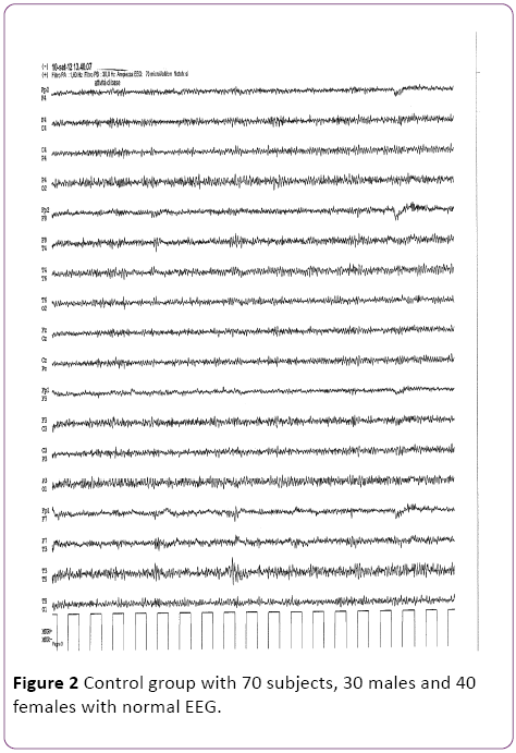jneuro-normal-EEG-7-5-158-g002
