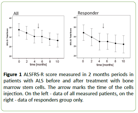 Mesenchymal Stem Cell Msc Transplantation In Patients With Amyotrophic Lateral Sclerosis Als Is There A Aƒa A A A A Responder Populationaƒa A A A A Insight Medical Publishing